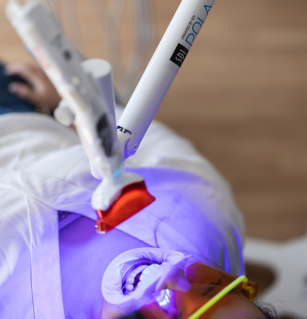 Teeth-Whitening-Device